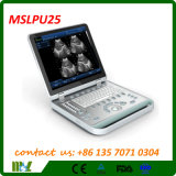 China 3D Ultrasound Machine Scanner PC Based Mslpu25