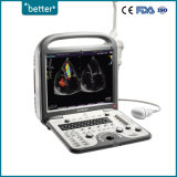 Full Digital Ultrasound Scanner 3D 4D Color Doppler Sonoscape S8