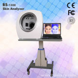 Skin Diagnosis Facial Skin Quality Analyzer