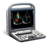 FDA 3D 4D Portable Ultrasound Machine for Pregnancy for Hot Sale