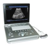 Med-B-Ss-9 Laptop Fully Digital 3D B/W Ultrasound Scanner