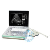 Veterinary Ultrasound (SonoScan L15A(V))