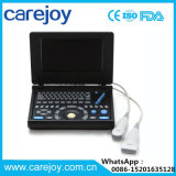 2016 New 3D Laptop Ultrasound Scanner Ultrasound System-Stella