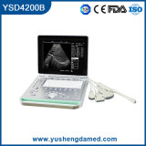 15 Inch 3D Hot Sale Hospital Ultrasound Scanner Ultrasonic Machine