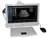 Med-B-Ss-7 Loptop Portalbe15 Inch Fully Digital Ultrasound Scanner