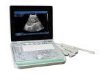 Ty-6868s-1plus Color Laptop Ultrasound Scanner